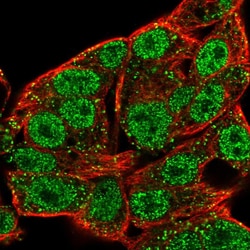Invitrogen STK39 Polyclonal Antibody 100 &mu;L; Unconjugated:Antibodies,