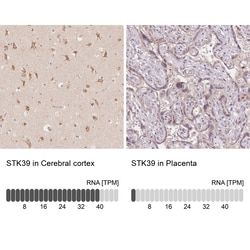 Invitrogen STK39 Polyclonal Antibody 100 &mu;L; Unconjugated:Antibodies,