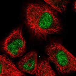 Invitrogen PHC3 Polyclonal Antibody 100 &mu;L; Unconjugated:Antibodies,
