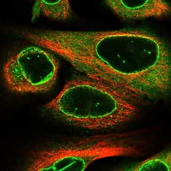 Invitrogen RANGAP1 Polyclonal Antibody 100 &mu;L; Unconjugated:Antibodies,