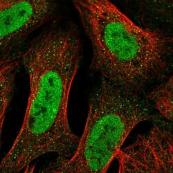 Invitrogen TRAK2 Polyclonal Antibody 100 &mu;L; Unconjugated:Antibodies,