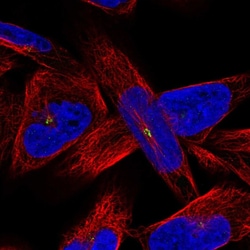 Invitrogen AMN1 Polyclonal Antibody 100 μL; Unconjugated:Antibodies,