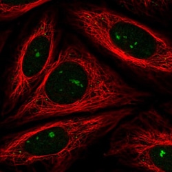 Invitrogen FBXW11 Polyclonal Antibody:Antibodies:Primary Antibodies