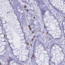 Invitrogen CD122 Polyclonal Antibody 100 &mu;L; Unconjugated:Antibodies,