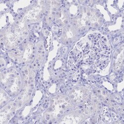 Invitrogen CD122 Polyclonal Antibody 100 &mu;L; Unconjugated:Antibodies,