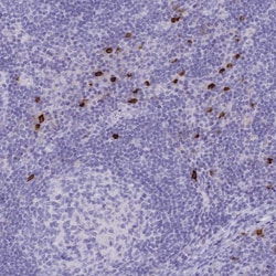 Invitrogen CD122 Polyclonal Antibody 100 &mu;L; Unconjugated:Antibodies,