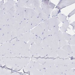 Invitrogen CD122 Polyclonal Antibody 100 &mu;L; Unconjugated:Antibodies,