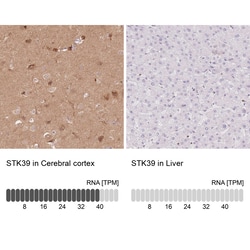 Invitrogen STK39 Polyclonal Antibody:Antibodies:Primary Antibodies