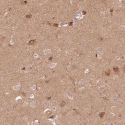 Invitrogen STK39 Polyclonal Antibody:Antibodies:Primary Antibodies