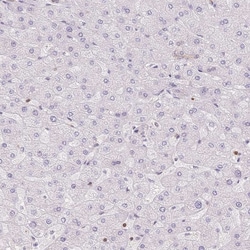 Invitrogen STK39 Polyclonal Antibody:Antibodies:Primary Antibodies