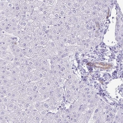 Invitrogen TGR5 Polyclonal Antibody 100 &mu;L; Unconjugated:Antibodies,
