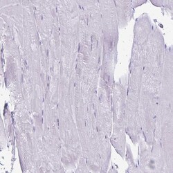 Invitrogen TGR5 Polyclonal Antibody 100 &mu;L; Unconjugated:Antibodies,