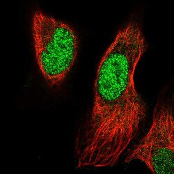 Invitrogen PRRX1 Polyclonal Antibody 100 &mu;L; Unconjugated:Antibodies,