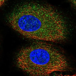 ACVR1B Polyclonal Antibody:Antibodies, Polyclonal