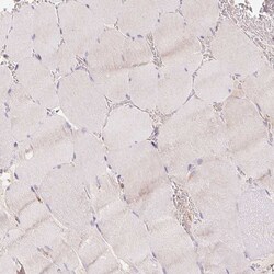 ACVR1B Polyclonal Antibody:Antibodies, Polyclonal