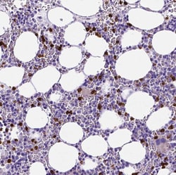 Invitrogen MMP9 Polyclonal Antibody 100 &mu;L; Unconjugated:Antibodies,