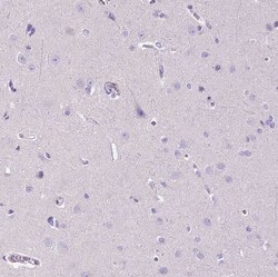 Invitrogen MMP9 Polyclonal Antibody 100 &mu;L; Unconjugated:Antibodies,