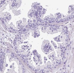 Invitrogen MMP9 Polyclonal Antibody 100 &mu;L; Unconjugated:Antibodies,