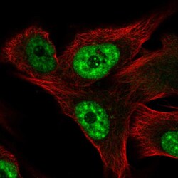 Invitrogen RCAN3 Polyclonal Antibody 100 &mu;L; Unconjugated:Antibodies,