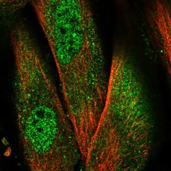 Invitrogen NALP1 Polyclonal Antibody 100 &mu;L; Unconjugated:Antibodies,