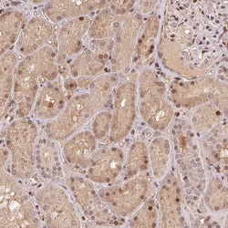 Invitrogen MAPKAPK2 Polyclonal Antibody 100 &mu;L; Unconjugated:Antibodies,