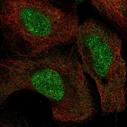 Invitrogen SETD8 Polyclonal Antibody 100 &mu;L; Unconjugated:Antibodies,