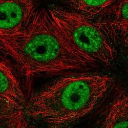 Invitrogen SF3B4 Polyclonal Antibody:Antibodies:Primary Antibodies