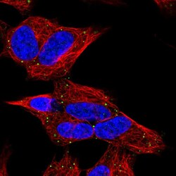 Invitrogen CERK Polyclonal Antibody 100 &mu;L; Unconjugated:Antibodies,