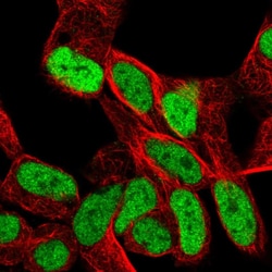 Invitrogen SMARCA1 Polyclonal Antibody 100 μL; Unconjugated:Antibodies,