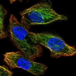 Invitrogen ATG4A Polyclonal Antibody 100 μL; Unconjugated:Antibodies,