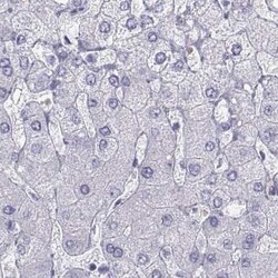 Invitrogen SEMG1 Polyclonal Antibody 100 μL; Unconjugated:Antibodies,