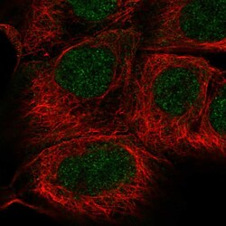 Invitrogen SGPP1 Polyclonal Antibody 100 &mu;L; Unconjugated:Antibodies,