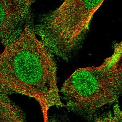 Invitrogen RNF8 Polyclonal Antibody 100 &mu;L; Unconjugated:Antibodies,