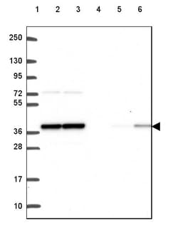 Invitrogen PP1 beta Polyclonal Antibody 100 &mu;L | Buy Online | Invitrogen&trade; | Fisher Scientific