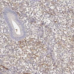Invitrogen IGFBP4 Polyclonal Antibody 100 &mu;L; Unconjugated:Antibodies,