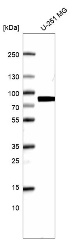 Invitrogen HEC1 Polyclonal Antibody 100 &mu;L; Unconjugated:Antibodies,