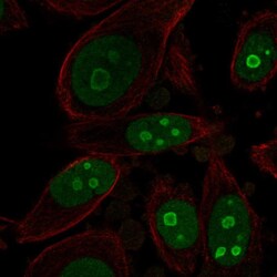 Invitrogen BOP1 Polyclonal Antibody 100 &mu;L; Unconjugated:Antibodies,