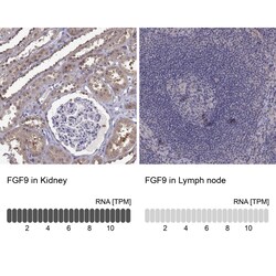 Invitrogen FGF9 Polyclonal Antibody 100 &mu;L; Unconjugated:Antibodies,