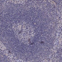 Invitrogen FGF9 Polyclonal Antibody 100 &mu;L; Unconjugated:Antibodies,