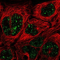 Invitrogen CRSP9 Polyclonal Antibody 100 &mu;L; Unconjugated:Antibodies,