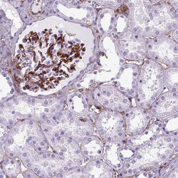 Invitrogen CD105 Polyclonal Antibody 100 &mu;L; Unconjugated:Antibodies,