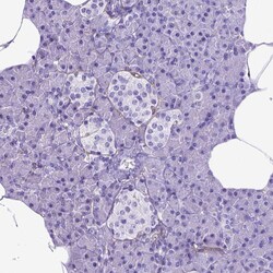 Invitrogen CD105 Polyclonal Antibody 100 &mu;L; Unconjugated:Antibodies,