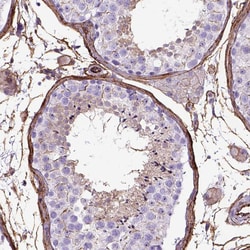 Invitrogen CD105 Polyclonal Antibody 100 &mu;L; Unconjugated:Antibodies,