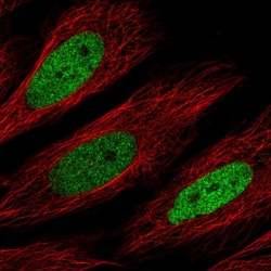Invitrogen C/EBP delta Polyclonal Antibody 100 &mu;L; Unconjugated:Antibodies,