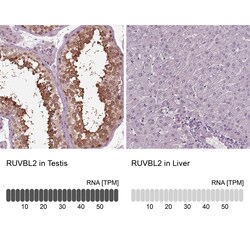Invitrogen RUVBL2 Polyclonal Antibody 100 &mu;L | Buy Online | Invitrogen&trade; | Fisher Scientific