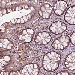 Invitrogen IL31RA Polyclonal Antibody 100 &mu;L; Unconjugated:Antibodies,