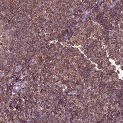 Invitrogen IL31RA Polyclonal Antibody 100 &mu;L; Unconjugated:Antibodies,