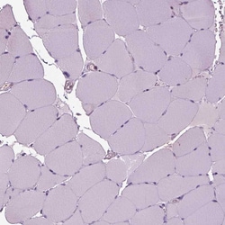 Invitrogen IL31RA Polyclonal Antibody 100 &mu;L; Unconjugated:Antibodies,