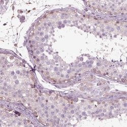 Invitrogen IL31RA Polyclonal Antibody 100 &mu;L; Unconjugated:Antibodies,