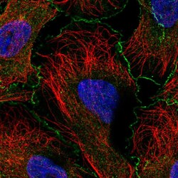 Invitrogen ABI1 Polyclonal Antibody 100 &mu;L; Unconjugated:Antibodies,